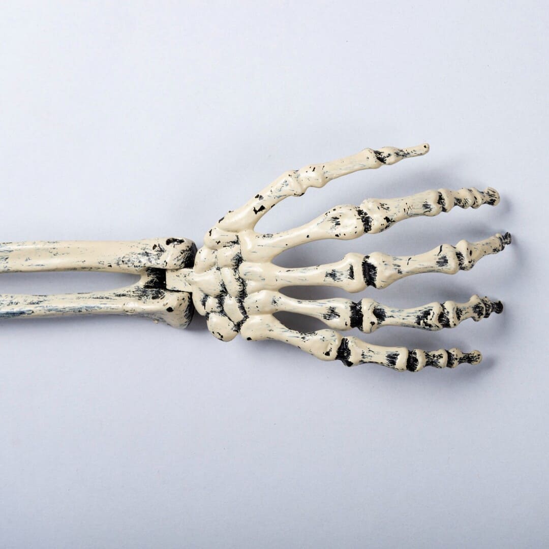 Cáncer de Huesos / OSTEOSARCOMA